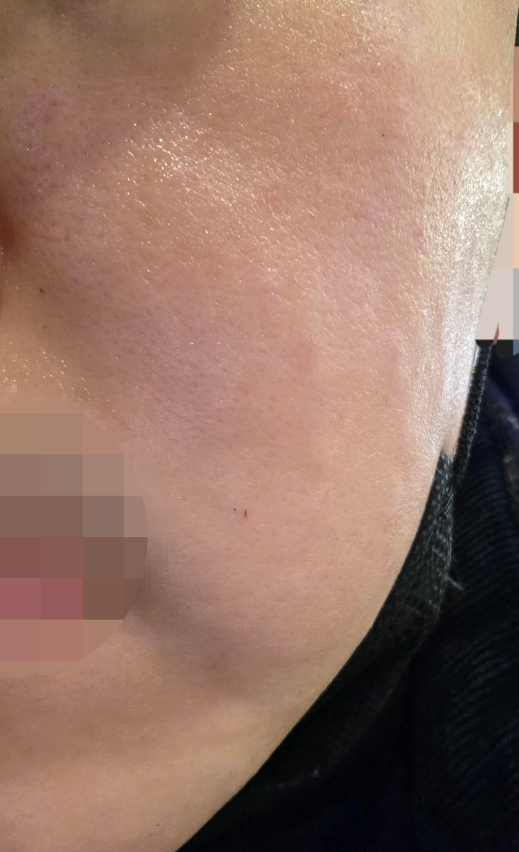 수술후기이미지