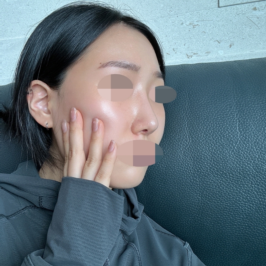 수술후기이미지