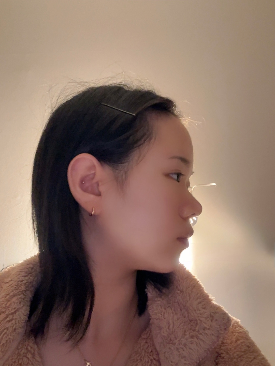 수술후기이미지